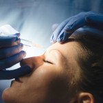 Botox treatment - Islington skin clinic