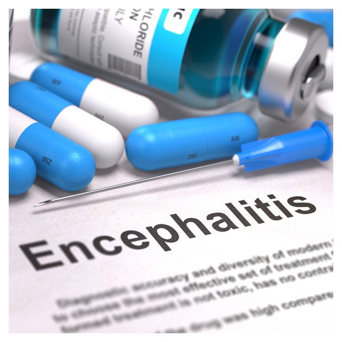 Tick Borne Encephalitis* 
