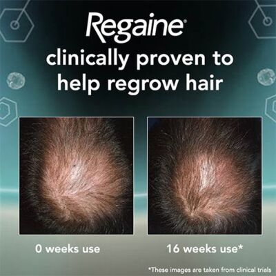 Regaine topical scalp foam 5% extra strength for men 5% 73ml 3 pack